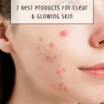 7 Best Acne Products That Actually Work (Clear Skin Fast in 2026)